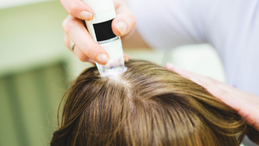 Scalp health is urgent, Ti-UNic Biotech has put effort on scalp care market(圖)