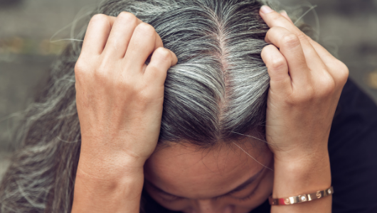 Stress makes hair gray : WHO also pays attention to scalp health(圖)